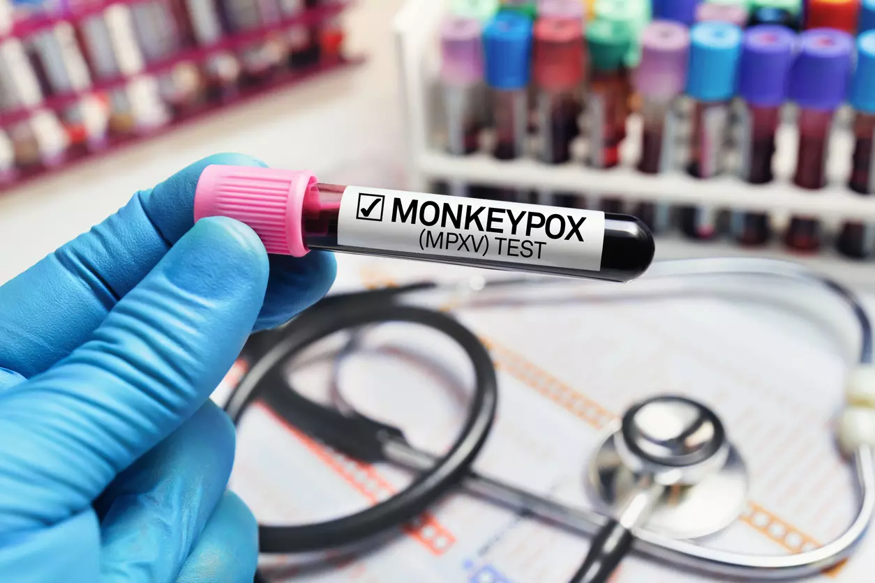 Monkeypox Menace| ಎಂಪಾಕ್ಸ್‌  ಮುಂದಿನ ಕೋವಿಡ್‌ ಆಗುವುದೇ?