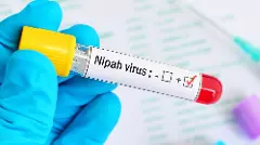 ನಿಫಾ ವೈರಸ್ | ‌ಬೆಂಗಳೂರಿನಲ್ಲಿದ್ದ ಕೇರಳ ವ್ಯಕ್ತಿ ನಿಫಾ ವೈರಸ್ ಸೋಂಕಿಗೆ ಬಲಿ