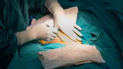 ಸಿಜೇರಿಯನ್‌ ಹೆರಿಗೆ | ತುಮಕೂರು, ಚಿತ್ರದುರ್ಗ ಮುಂದೆ: ಖಾಸಗಿ ಆಸ್ಪತ್ರೆಗಳಿಗೆ ಇಲ್ಲ ಕಡಿವಾಣ