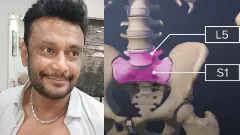 Darshan Case | ನಟ ದರ್ಶನ್‌ ಬೆನ್ನುನೋವು ಶಸ್ತ್ರಚಿಕಿತ್ಸೆ: ವೈದ್ಯರು ನೀಡಿದ ಅಪ್‌ಡೇಟ್‌ ಏನು?