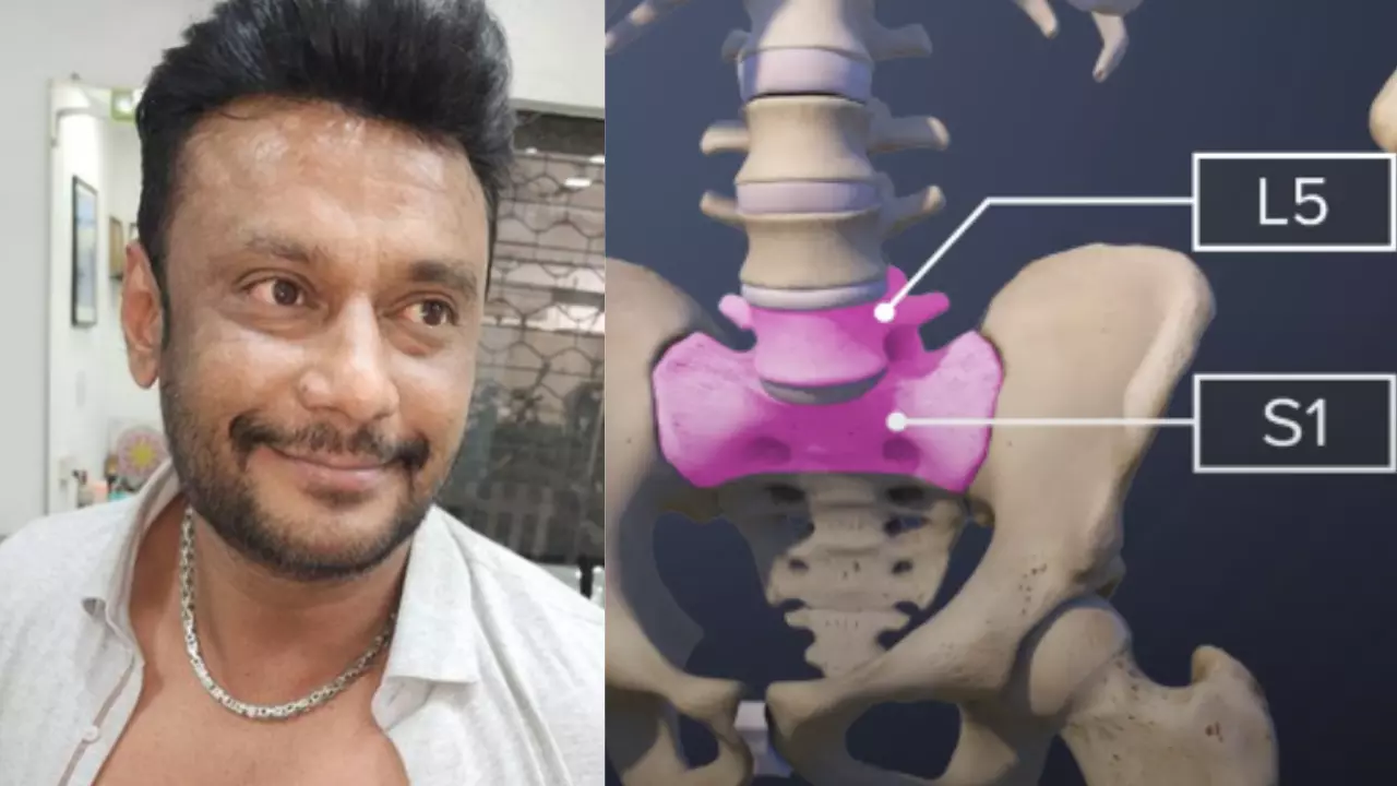 Darshan Case | ನಟ ದರ್ಶನ್‌ ಬೆನ್ನುನೋವು ಶಸ್ತ್ರಚಿಕಿತ್ಸೆ: ವೈದ್ಯರು ನೀಡಿದ ಅಪ್‌ಡೇಟ್‌ ಏನು?