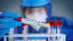 Covid-19: ಭಾರತದಲ್ಲಿ ಕೋವಿಡ್ ಪ್ರಕರಣಗಳ ಬಗ್ಗೆ ಆತಂಕಕ್ಕೆ ಬೇಡ ಎಂದ ಆರೋಗ್ಯ ತಜ್ಞರು