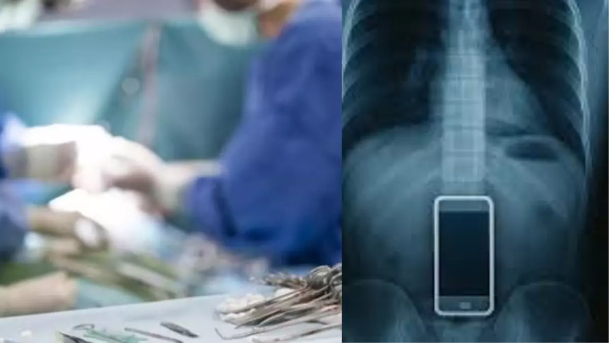 Prisoner admitted to hospital with stomach pain finds mobile phone in his stomach Prisoner admitted to hospital with stomach pain finds mobile phone in his stomach