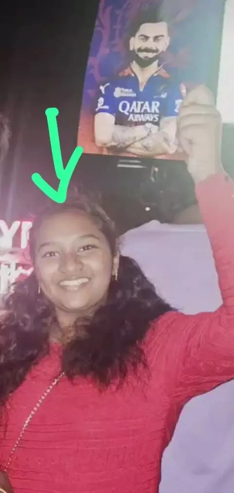 ಆರ್‌ಸಿಬಿ ಕಾಲ್ತುಳಿತ : ಶವ ಪರೀಕ್ಷೆ ವೇಳೆ ಮೃತ ಬಾಲಕಿಯ ಮೈಮೇಲಿದ್ದ 1 ಲಕ್ಷ ರೂ. ಮೌಲ್ಯದ ಚಿನ್ನಾಭರಣ ಕಳವು!