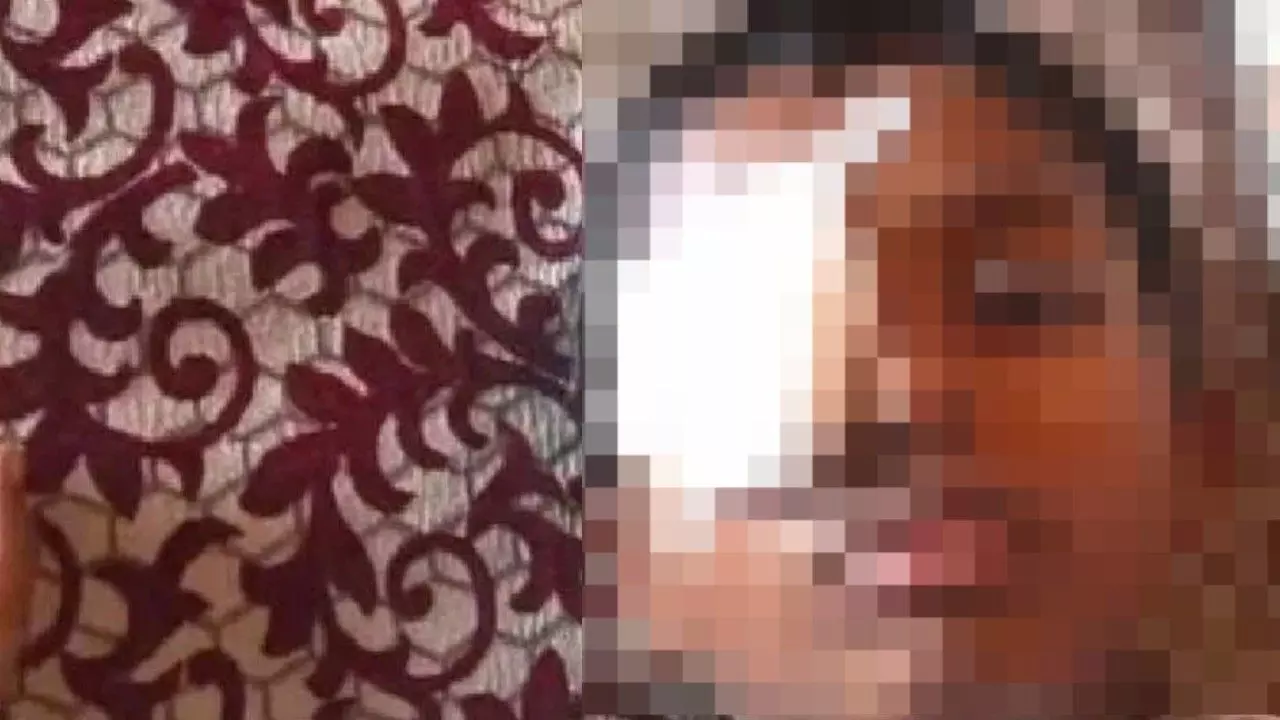 ಬಾಗಲಕೋಟೆಯಲ್ಲಿ ಪೆನ್‌ಗಾಗಿ ನಡೆದ ಜಗಳದಲ್ಲಿ ಕಣ್ಣುಗುಡ್ಡೆ ಕಳೆದುಕೊಂಡ ವಿದ್ಯಾರ್ಥಿ!