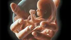 Fetal gender detected in Andhra by woman from the state, case registered by officials through undercover operation