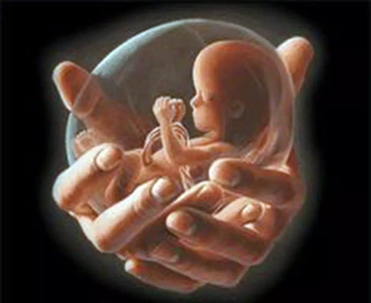 Fetal gender detected in Andhra by woman from the state, case registered by officials through undercover operation Fetal gender detected in Andhra by woman from the state, case registered by officials through undercover operation
