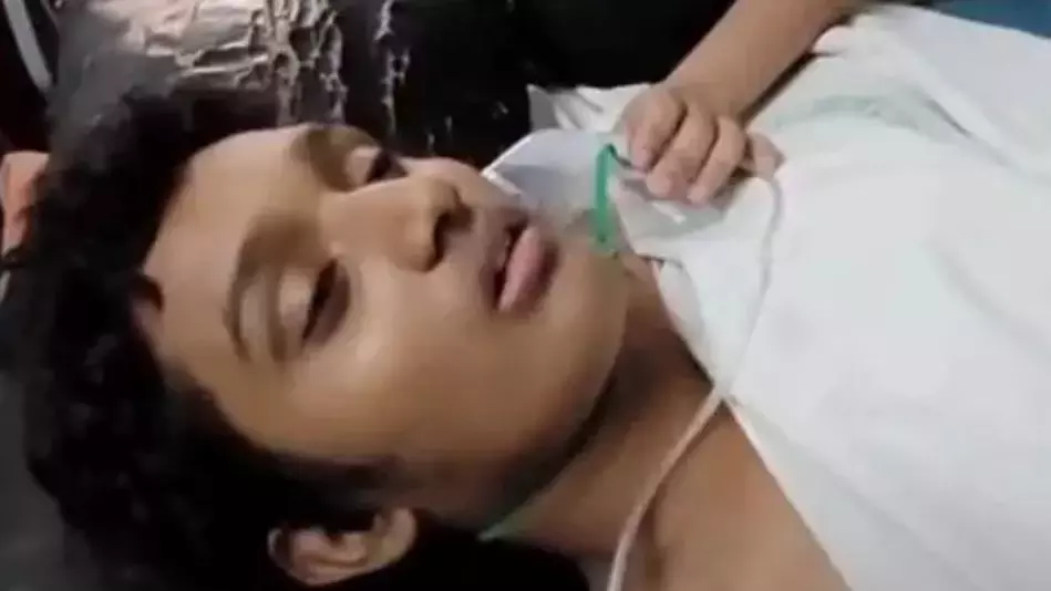 ಸ್ನೇಹಿತರ ಜೊತೆ ಬೆಟ್ಟಿಂಗ್;‌ ಪೆನ್ನು ನುಂಗಿದ ಬಾಲಕ- 3 ವರ್ಷಗಳ ನಂತರ ಹೊರತೆಗೆದ ವೈದ್ಯರು