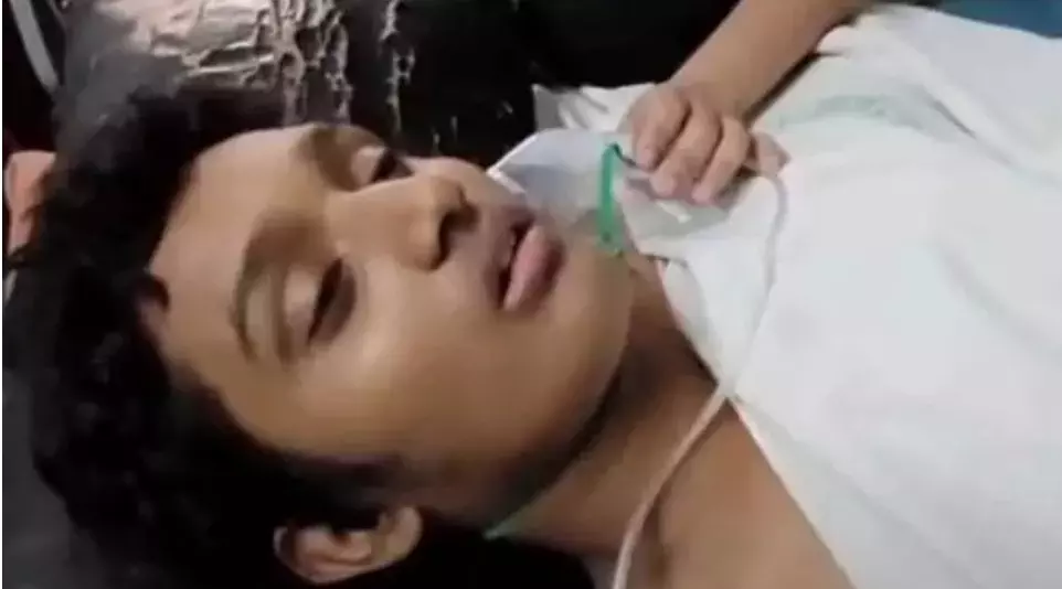 ಸ್ನೇಹಿತರ ಜೊತೆ ಬೆಟ್ಟಿಂಗ್; ಪೆನ್ನು ನುಂಗಿದ ಬಾಲಕ- 3 ವರ್ಷಗಳ ನಂತರ ಹೊರತೆಗೆದ ವೈದ್ಯರು ಸ್ನೇಹಿತರ ಜೊತೆ ಬೆಟ್ಟಿಂಗ್; ಪೆನ್ನು ನುಂಗಿದ ಬಾಲಕ- 3 ವರ್ಷಗಳ ನಂತರ ಹೊರತೆಗೆದ ವೈದ್ಯರು