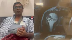 A Bengaluru techie fell into a pothole in Bengaluru and broke his shoulder!