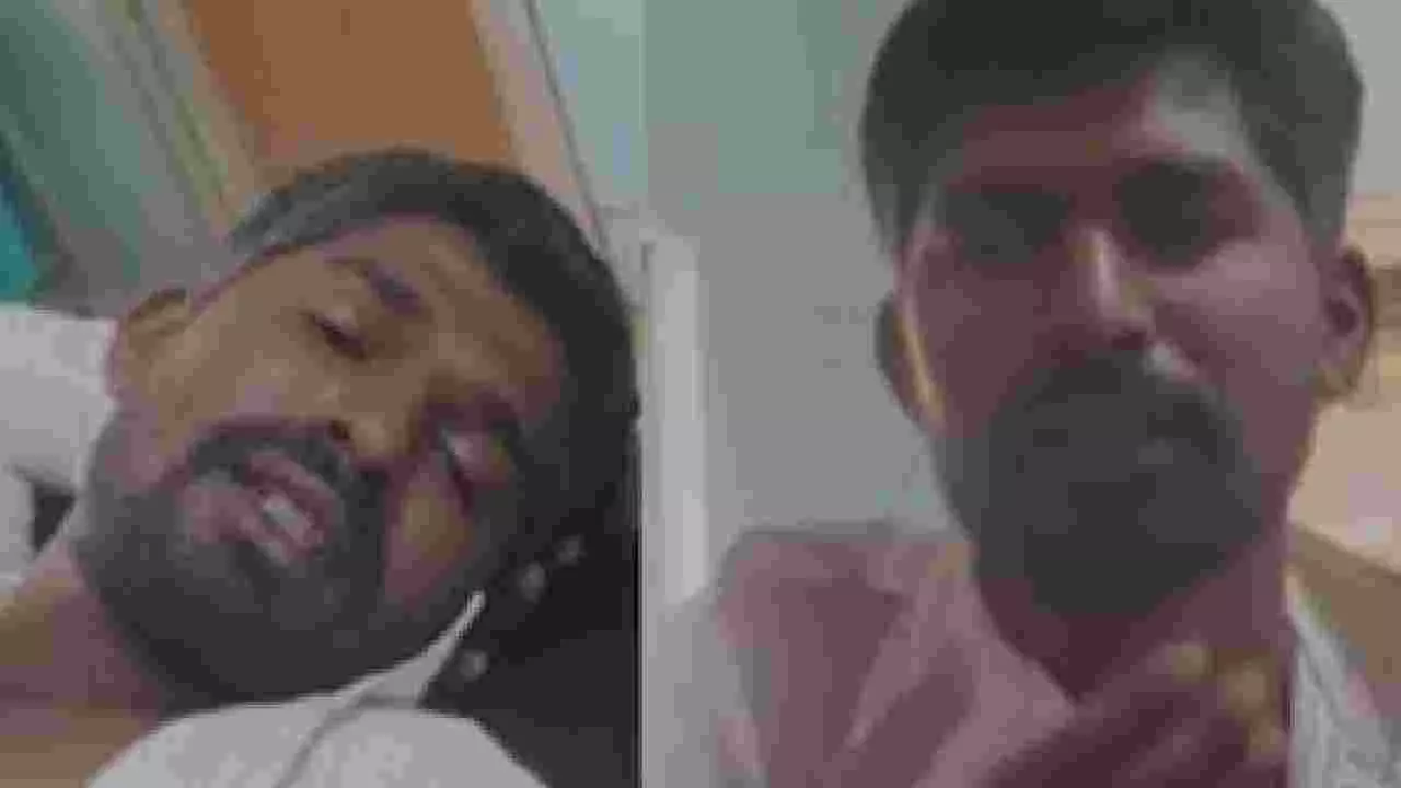 ಗ್ರಾಮದ ಸಮಸ್ಯೆ ಹೇಳಲು ಹೋದವನಿಗೆ ಕಚ್ಚಿ, ಚಪ್ಪಲಿಯಿಂದ ಹೊಡೆದ ಪಂಚಾಯತ್ ಅಧ್ಯಕ್ಷ!