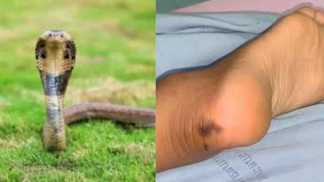 Immediate free treatment for snakebite, private hospitals cannot ask for advance payment: Government orders