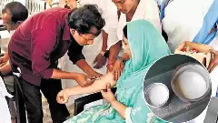 ರಾಜಮಂಡ್ರಿ ಕಲಬೆರಕೆ ಹಾಲು ಪ್ರಕರಣ: ಕಿಡ್ನಿ ವೈಫಲ್ಯದಿಂದ 16 ಮಂದಿ ಸಾವು, ಮುಂದುವರಿದ ಆತಂಕ